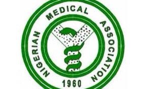 NMA