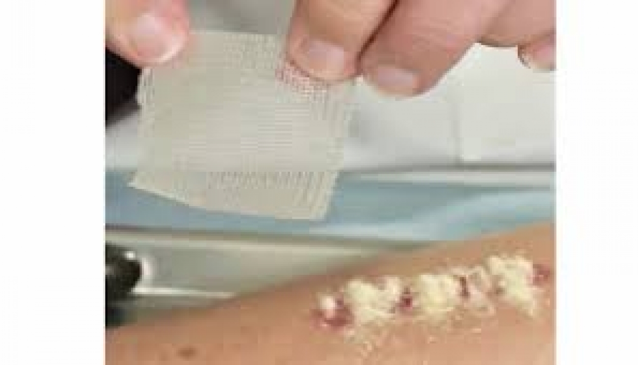 Applying antibiotic powder on fresh wounds to aid healing crude, can cause ulceration, surgeon warns